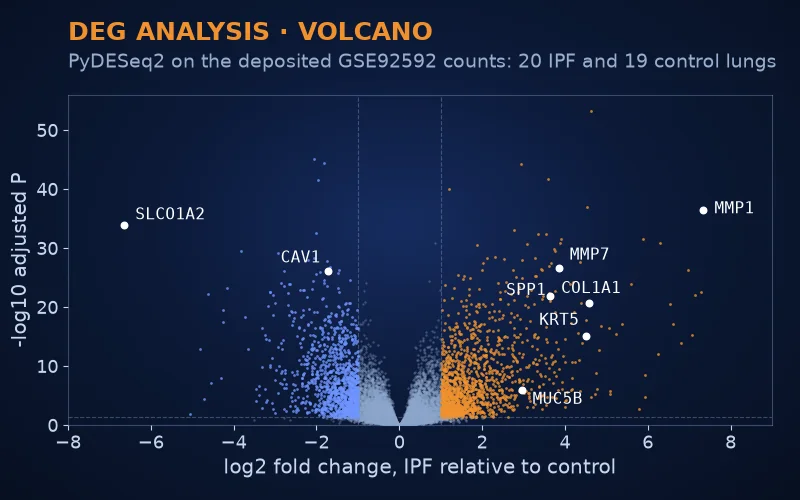 Volcano plot of differential expression between fibrotic and control lung with named genes marked